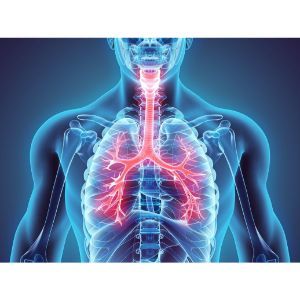 What Causes Humidifier Lung